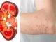 9 triệu chứng khi mắc bệnh thận, suy thận ai cũng cần biết