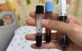 Bé gái 16 tháng tím tái vì ăn ghẹ, rau nấu nước giếng nhiễm nitrat