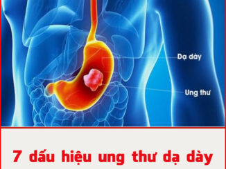 7 dấu hiệu ung thư dạ dày giai đoạn sớm, ai cũng cần biết kẻo di căn xa