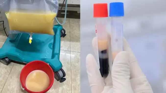 Mê mẩn loại nước này, nhiều người Việt nhận hậu quả nghiêm trọng, 🩸 trắng đục như sữa Mê mẩn loại nước này, nhiều người Việt nhận hậu quả nghiêm trọng, 🩸 trắng đục như sữa
