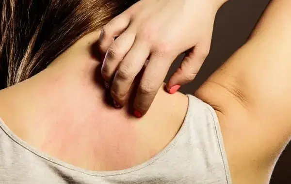 Cẩn thận: Ngứa 2 chỗ này trên cơ thể là biểu hiện của bệnh gan, đừng nhầm với dị ứng