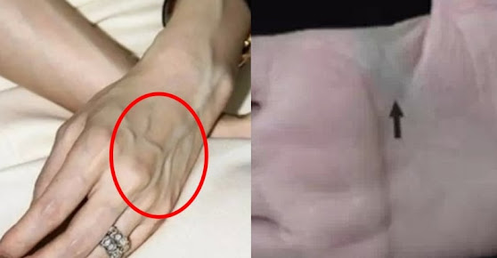 Nhìn thấy ai có “gân xanh” nhất định phải nói cho họ biết điều này, vì sẽ cứu sống họ đấy