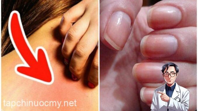 Ung thư ƌừng ƌể quá muộn: Bác sĩ Bệnh viện Việt Đức cảnh Ьáo 6 dấu hiệu không thể Ьỏ quɑ Ung thư ƌừng ƌể quá muộn: Bác sĩ Bệnh viện Việt Đức cảnh Ьáo 6 dấu hiệu không thể Ьỏ quɑ