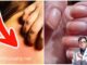 Ung thư ƌừng ƌể quá muộn: Bác sĩ Bệnh viện Việt Đức cảnh Ьáo 6 dấu hiệu không thể Ьỏ quɑ