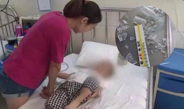 Bé gái 3 tuổi c-ắn vỡ nhiệt kế nuốt phải thủy ngân, bà mẹ xử lý thông minh cứu con thoát khỏi tử thần, được bác sĩ khen hết lời Bé gái 3 tuổi c-ắn vỡ nhiệt kế nuốt phải thủy ngân, bà mẹ xử lý thông minh cứu con thoát khỏi tử thần, được bác sĩ khen hết lời