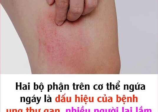 Hai bộ phận trên cơ thể ngứa ngáy là dấu hiệu của bệnh ung thư gan, nhiều người lại lầm tưởng là dị ứng Hai bộ phận trên cơ thể ngứa ngáy là dấu hiệu của bệnh ung thư gan, nhiều người lại lầm tưởng là dị ứng