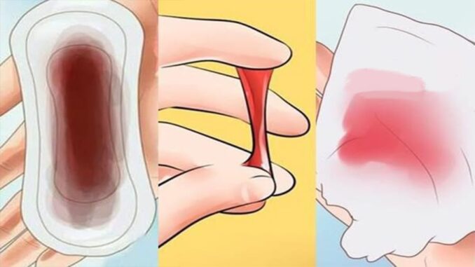 5 dấu hiệu u-ng thư cổ t-ử cung sớm nhất: 90% chị em xem thường bỏ qua