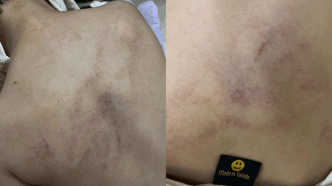 Nóng: Bé gái 4 tuổi bị cô giáo mầm non công lập ở Hà Nội bạo hành dã man, trích xuất camera phát hiện hành động gây sốc Nóng: Bé gái 4 tuổi bị cô giáo mầm non công lập ở Hà Nội bạo hành dã man, trích xuất camera phát hiện hành động gây sốc