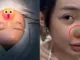 Ngân 98 lộ nốt sưng đỏ ở mũi, hủy gấp 2 show tại Campuchia, bác sĩ chẩn đoán sốc