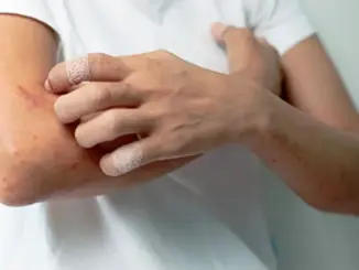 Cẩn trọng khi ngứa ở 2 bộ phận này, có thể là UT gan chứ không phải dị ứng