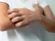 Cẩn trọng khi ngứa ở 2 bộ phận này, có thể là UT gan chứ không phải dị ứng