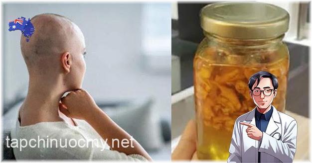 BS trả về, cô gái ở nhà kiên trì dùng gừng pha mật ong, đi khám lại thì tế bào ung thư đã mất BS trả về, cô gái ở nhà kiên trì dùng gừng pha mật ong, đi khám lại thì tế bào ung thư đã mất