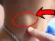 Người sắp bị K tấn công thường có 3 dấu hiệu lạ ở cổ, có 1 cái thôi đã là báo động