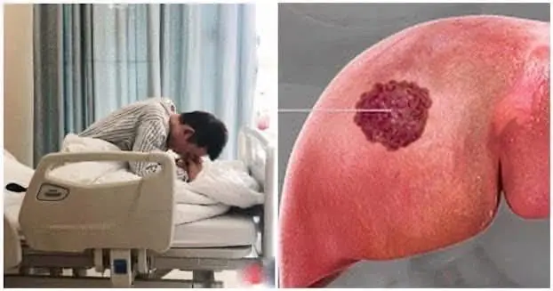 Bệnh nhân qua đời sau 60 ngày phát hiện UT g: an, BS khẩn cầu: Đừng ăn 2 món h:ủy d: iệt g: an nữa Bệnh nhân qua đời sau 60 ngày phát hiện UT g: an, BS khẩn cầu: Đừng ăn 2 món h:ủy d: iệt g: an nữa