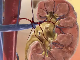 8 dấu hiệu suy thận giai đoạn đầu bạn không nên bỏ qua