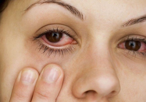 3 dấu hiệu ở mắt cảnh báo đột quỵ, UT ‘ghé thăm’