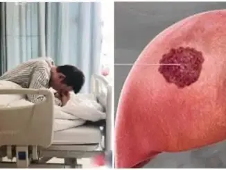 Bệnh nhân qua đời sau 60 ngày phát hiện UT g: an, BS khẩn cầu: Đừng ăn 2 món h:ủy d: iệt g: an nữa