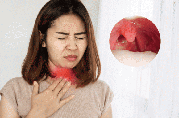 Cảnh báo: Khi thấy cơ thể có dấu hiệu này phải tới bệnh viện ngay kẻo UT vòm họng giai đoạn cuối Cảnh báo: Khi thấy cơ thể có dấu hiệu này phải tới bệnh viện ngay kẻo UT vòm họng giai đoạn cuối