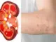 8 dấu hiệu suy thận giai đoạn đầu bạn không nên bỏ qua