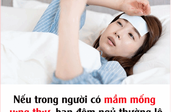 Nếu trong người có mầm mống u;ng th;ư, ban đêm ngủ thường lộ ra 3 đặc điểm nhưng nhiều người chủ quan