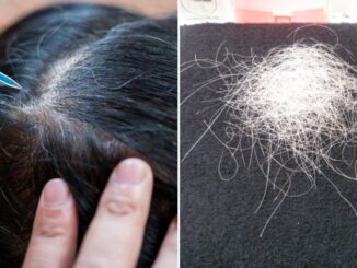 Thường xuyên nhổ tóc bạc, tóc sâu gây ra 4 tác hại này